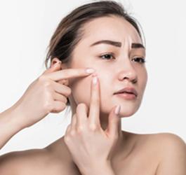 How Vitamin E Can Treat Acne & Turn Your Skin Ravishing?